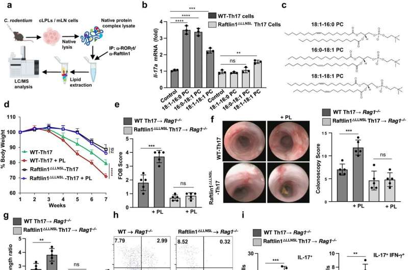 Researchers identify driver of inflammatory bowel disease 