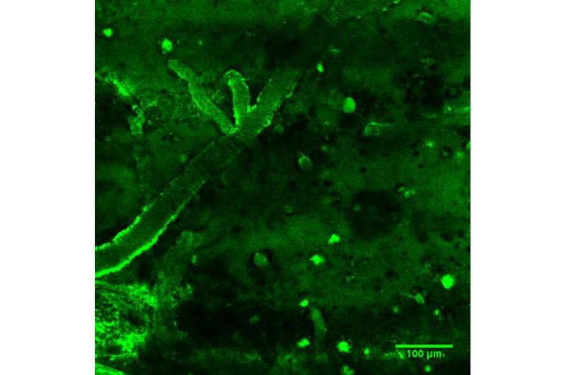 Diagnosis of Alzheimer's disease: Llama antibodies detect cerebral lesions