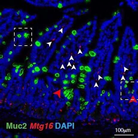 Researchers uncover drivers of healthy gut maintenance 