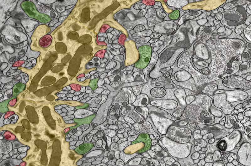 Electron microscope image of neurons in the cerebellum. This slice through the cells in the cerebellum shows a dendritic branch of a Purkinje cell and its side arms (yellow) receiving several excitatory inputs (green) and inhibitory inputs (red). Credit: Walter Kaufmann / ISTA