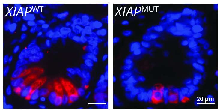 Researchers identify pathway critical for the development and prevention of intestinal inflammation 