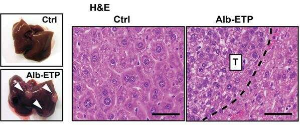 New therapeutic avenue in the fight against chronic liver disease