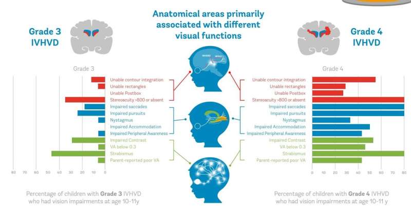 “Brain bleeds” in babies' first year can lead to long-term vision problems, study finds