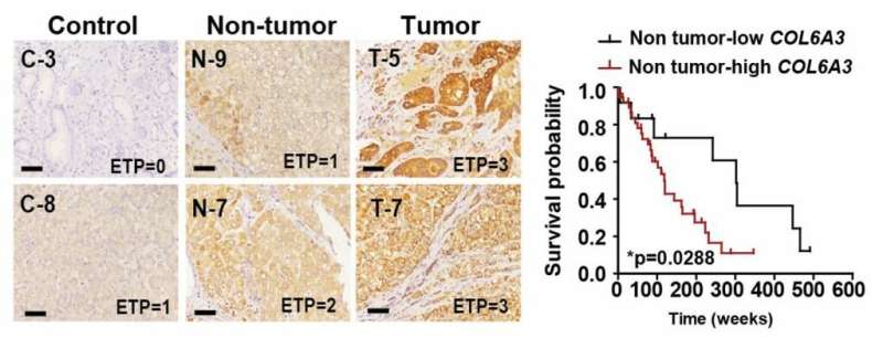 New therapeutic avenue in the fight against chronic liver disease