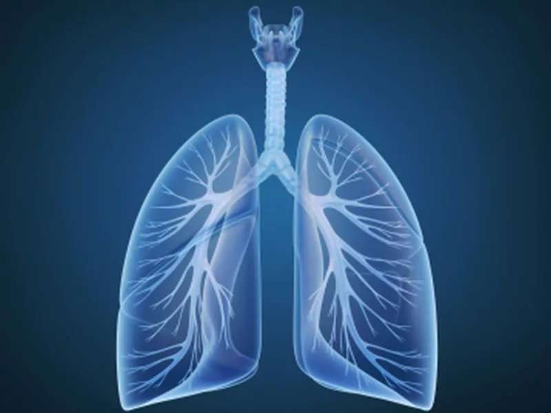 Lung cancer screening implementation guide developed 