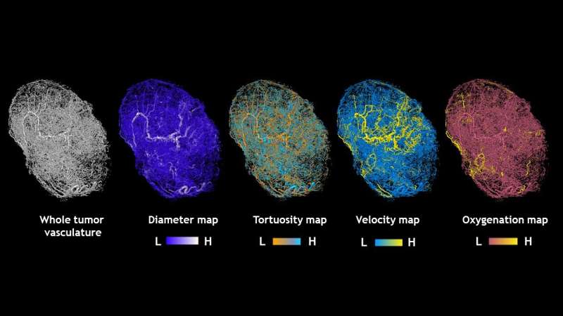 'Google Maps' for cancer: Image-based computer model reveals finer details of tumor blood flow