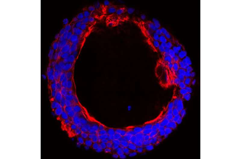 The sugar-attaching enzyme that defines colon cancer