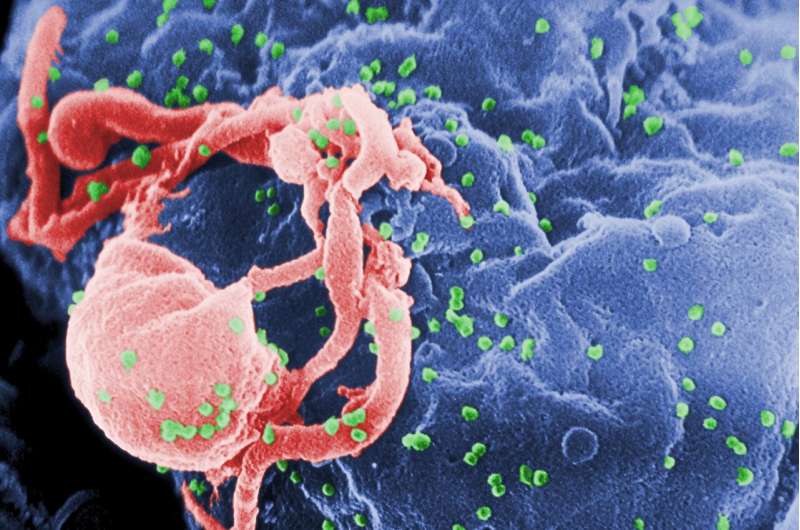 HIV infection leaves a 'memory' in cells 