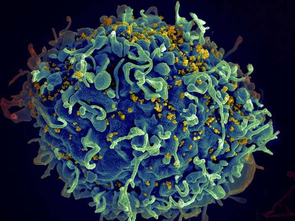 HIV RNA expression inhibitors may restore immune function in HIV-infected individuals 