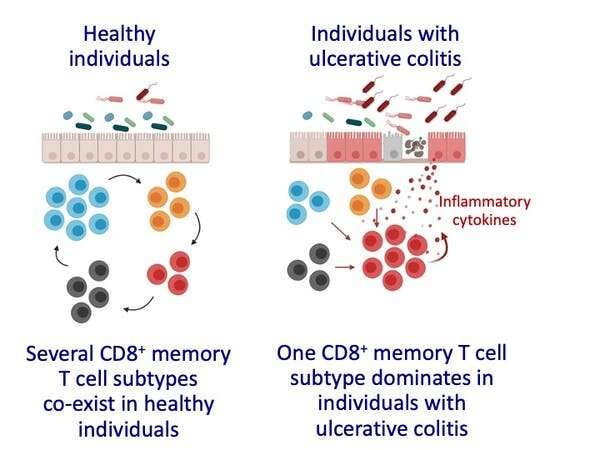 IBD: How a class of killer T cells goes rogue in inflammatory bowel disease 