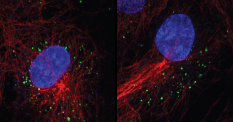 HIV infection hijacks intracellular highways