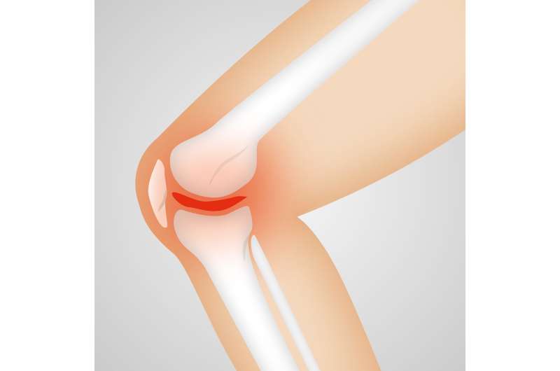 Mast cell levels may explain sex differences in osteoarthritis pain 