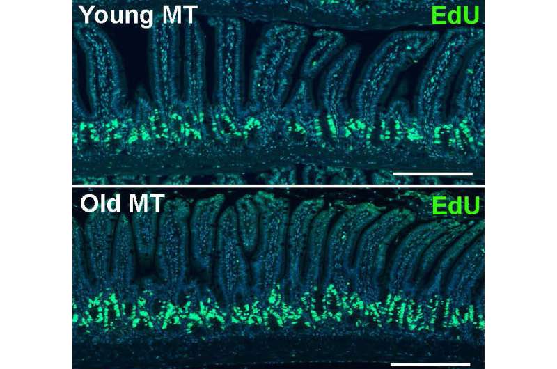 Bacteria in the gut may alter aging process, study finds 