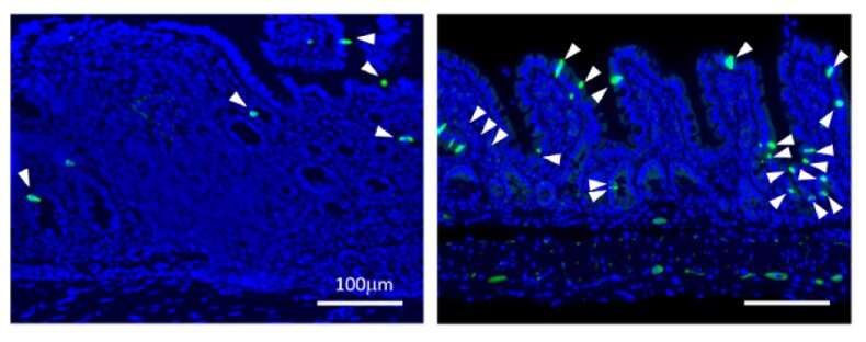 Research shows stimulating tuft cell production reverses intestinal inflammation 