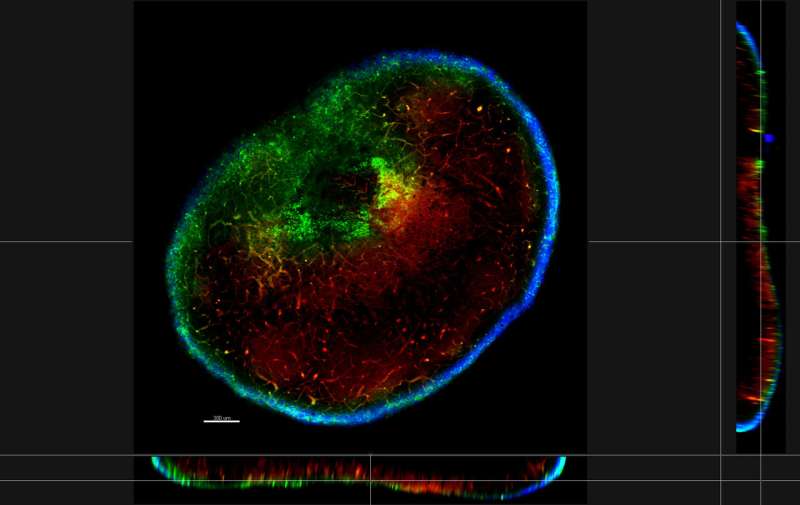 Metastatic lymph nodes can be the source of distant metastases in mouse models of cancer