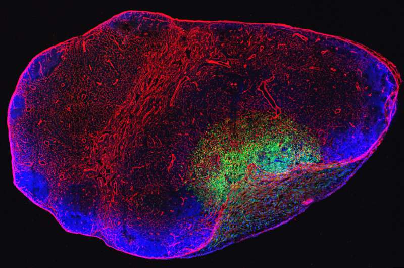 Metastatic lymph nodes can be the source of distant metastases in mouse models of cancer