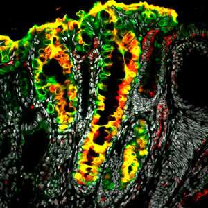 Stem cell reserves found in the stomach have implications for the genesis of gastric cancer 