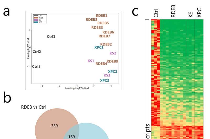 A common genetic signature has been discovered among three cancer prone rare skin diseases 