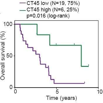 Novel biomarker found in ovarian cancer patients can predict response to therapy