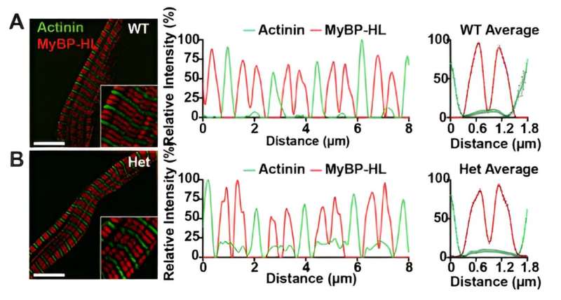 Novel protein interactions may serve as biomarker for heart disease