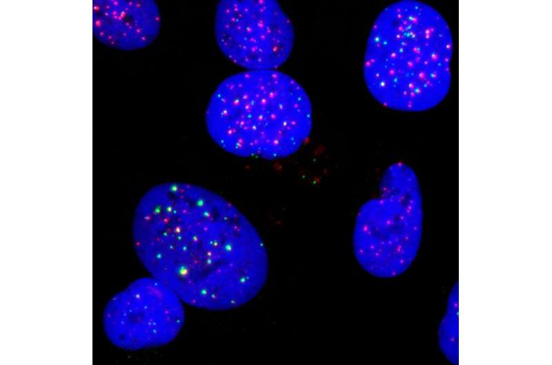 TLK protein inhibition activates the innate immune system 