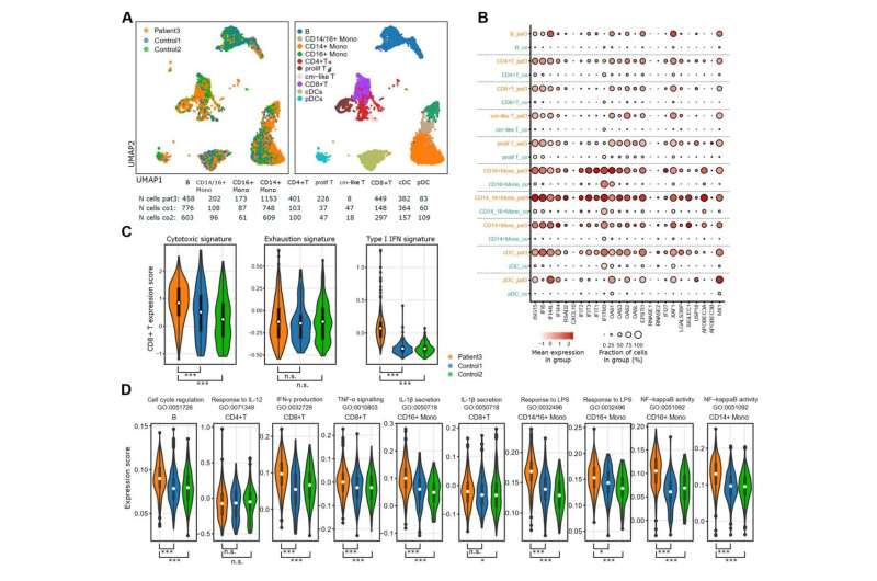 New genetic findings offer therapeutic approaches for incurable autoimmune disease SLE