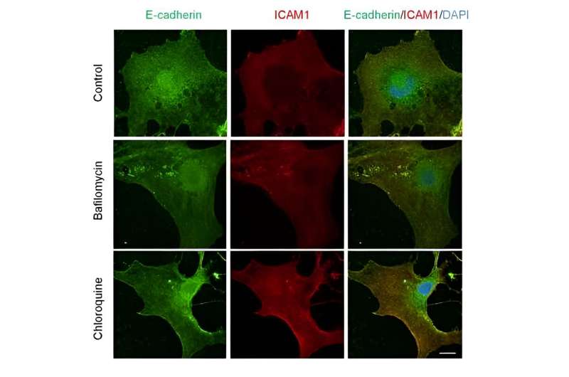 Inflammation discovery advances the fight against chronic liver disease