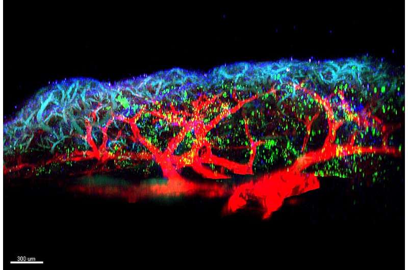 Respiratory allergies: newly discovered molecule plays a major role in triggering inflammation