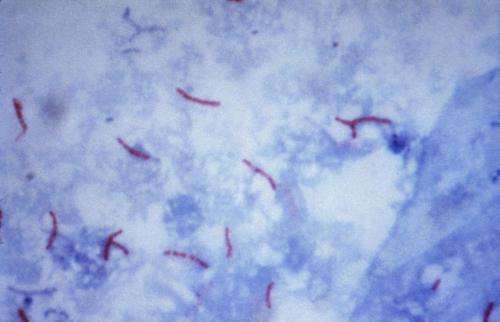 AI can help predict responses to specific tuberculosis treatments, paving way for personalized care