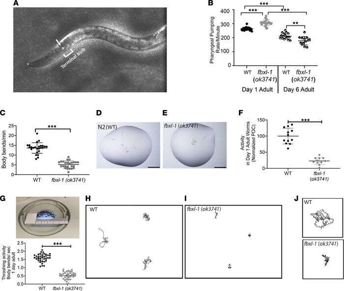 Researchers discover first therapeutic option for patients with rare and aggressive form of mitochondrial disease 