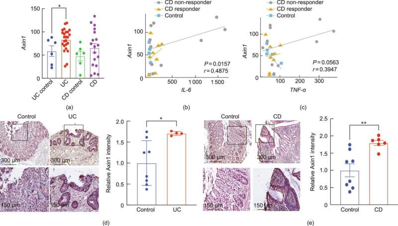 New research reveals gut microbiota link to colitis