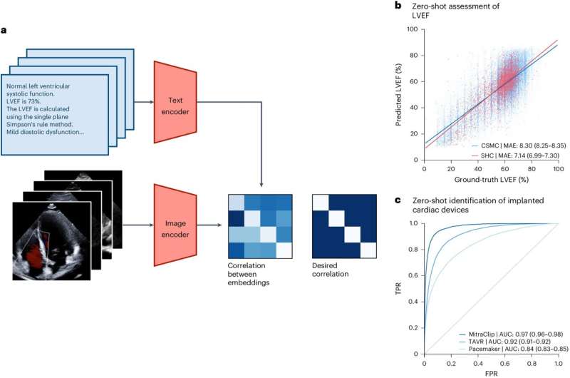 Cardiologists train large AI model to assess heart structure, function