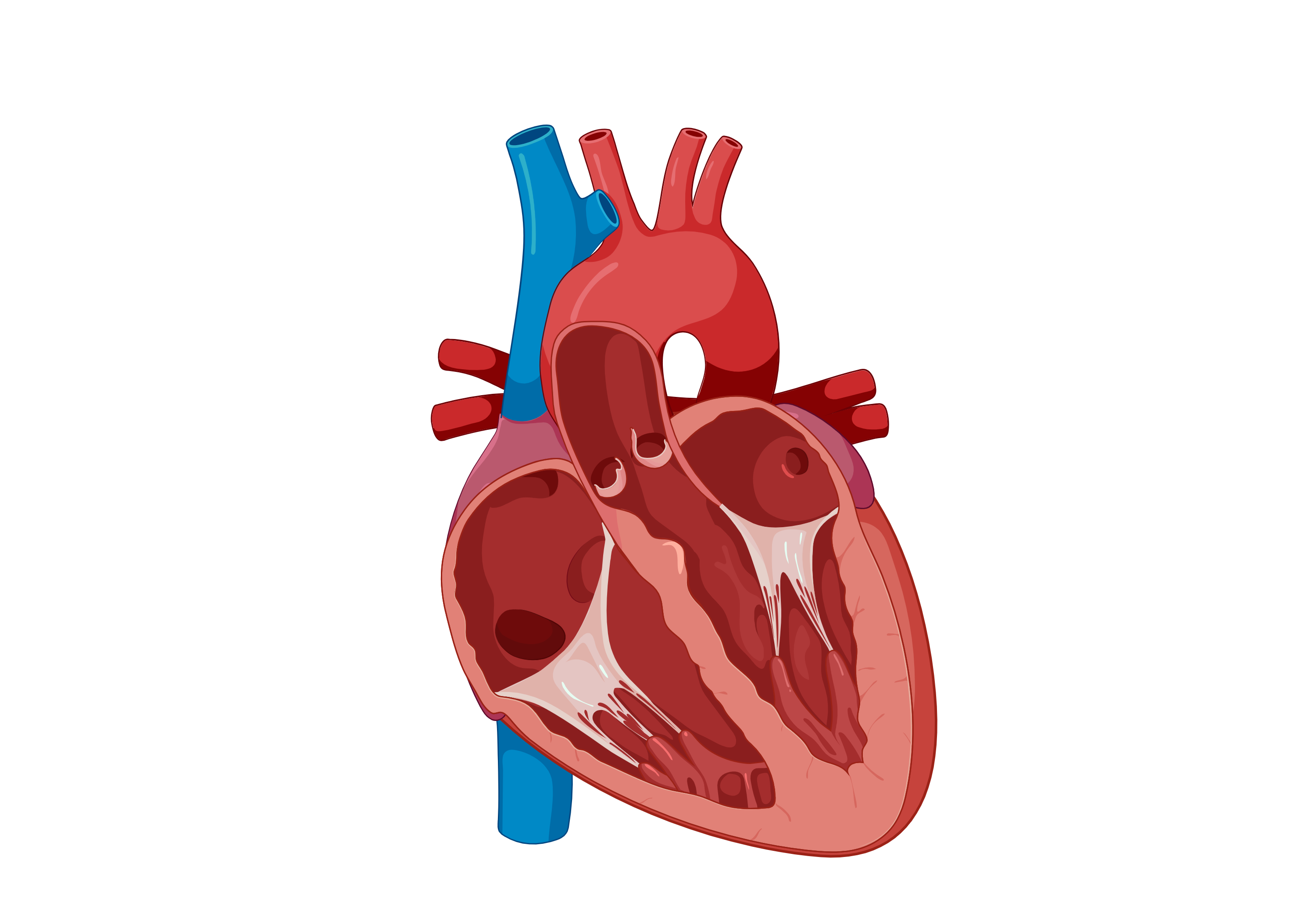 Biomimetic transcatheter aortic heart valve offers new option for aortic stenosis patients