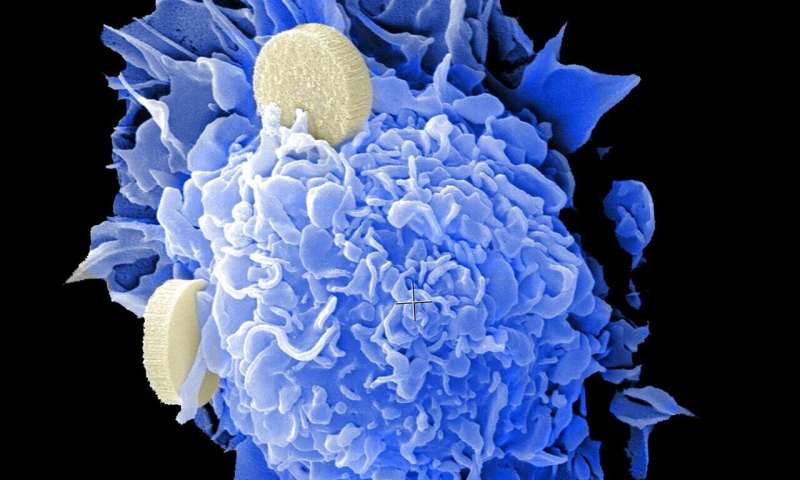 A metabolic enzyme as a potential new target for cancer immune therapies 