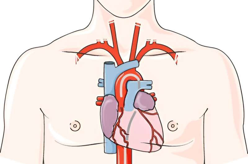 Pre-procedural strategy for cardiac catheterization found to improve patient well-being and satisfaction