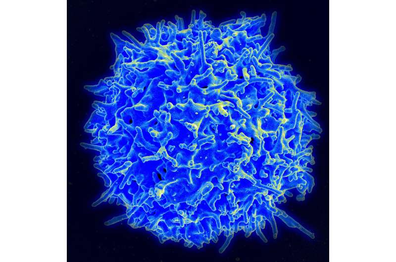 T cells alone are sufficient to establish and maintain HIV infection in the brain 
