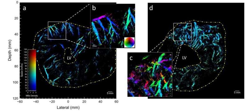 Microscopic heart vessels imaged in super-resolution for the ﬁrst time