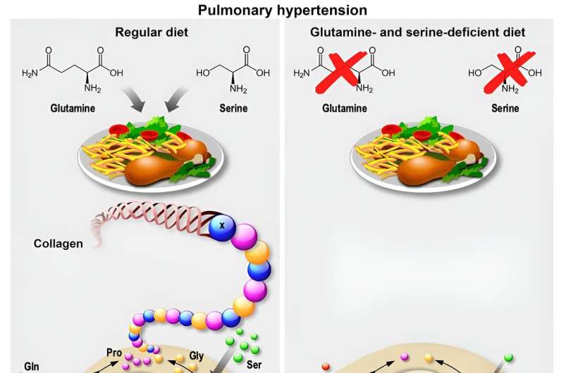 Dietary changes may help treat pulmonary hypertension
