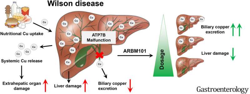 Bacterial agent opens new therapeutic options for Wilson's disease