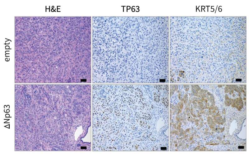 Pancreatic cancer's addiction could be its end 