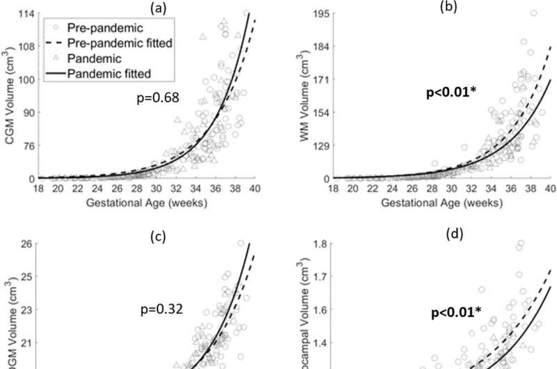 Pandemic distress may affect fetal brain development, small study finds