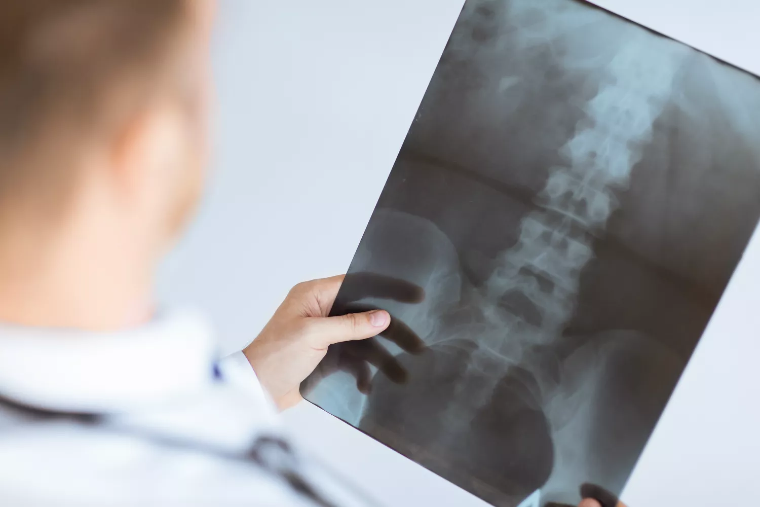 An Overview of Spinal Lesions