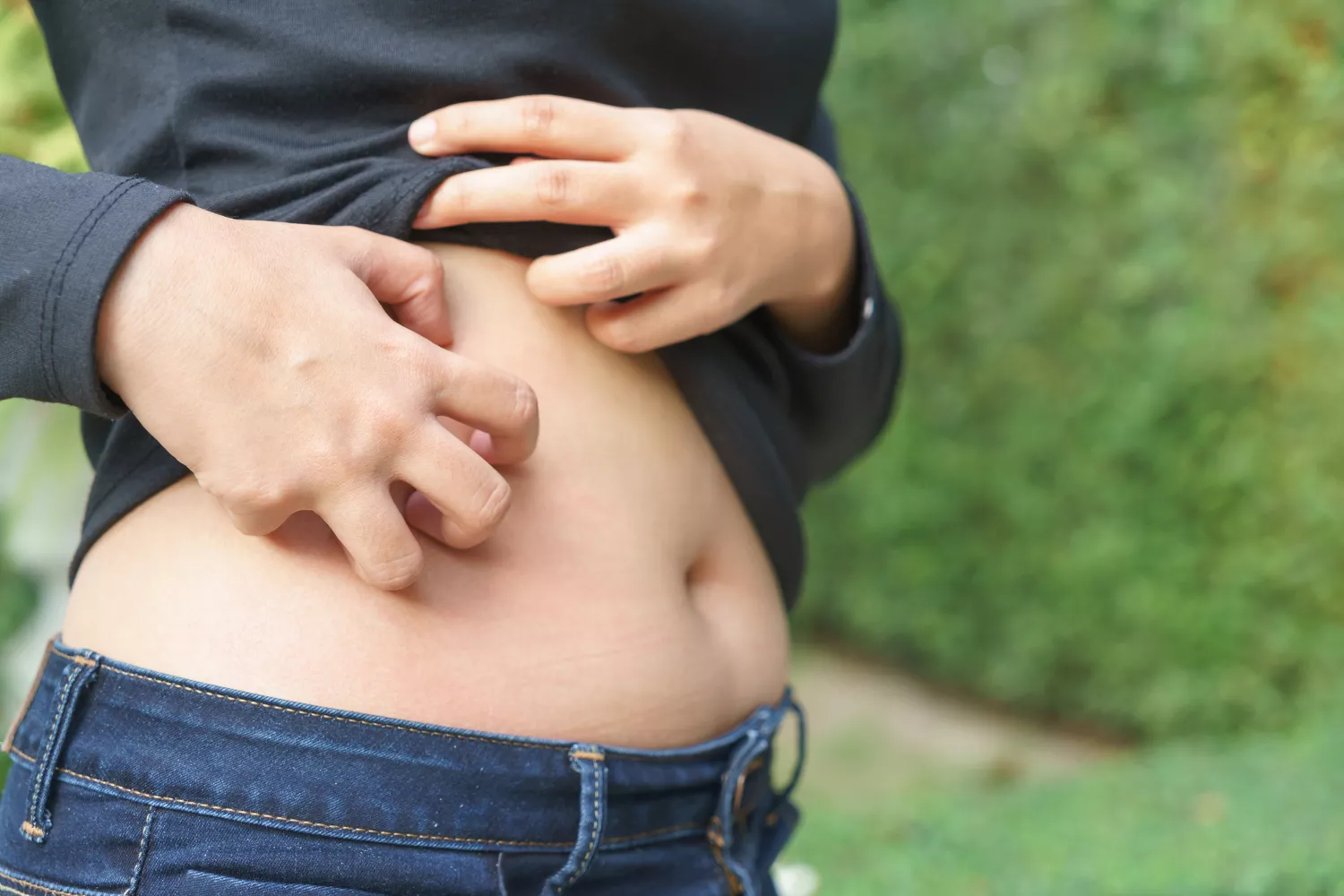 Itchy Stomach: Symptoms, Causes, and Treatment