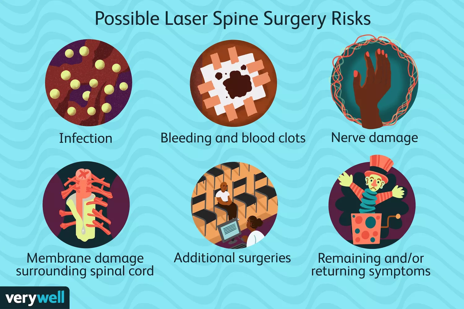 Laser Spine Surgery: Everything You Need to Know