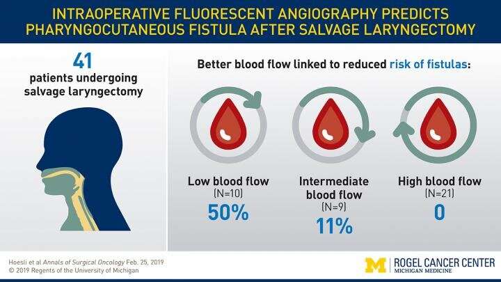 A new way to predict complications after larynx cancer surgery