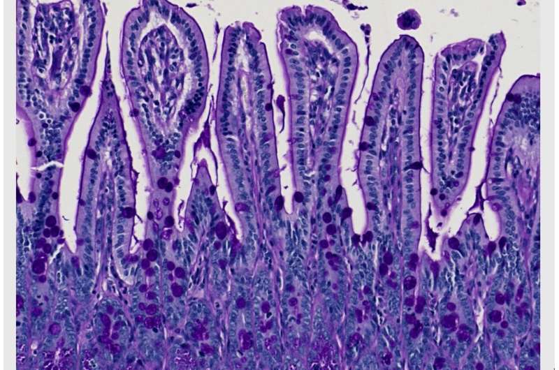 To trigger Crohn's disease, pathogenic bacteria co-opt a genetic susceptibility