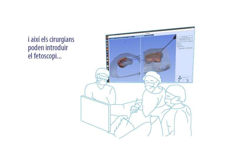 Research team creates a surgical navigation system for fetal surgery 