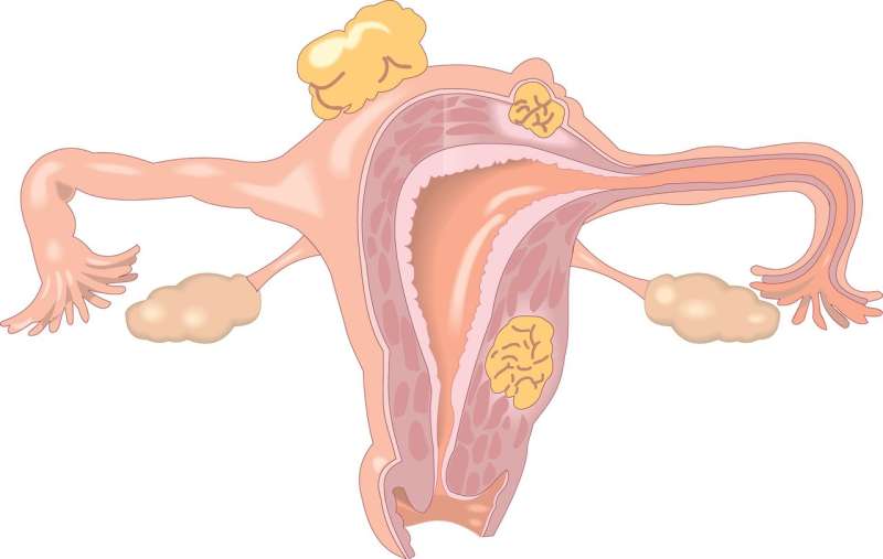 uterus