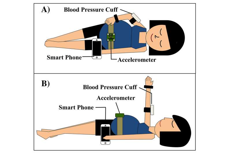 Researchers developing device to detect pregnancy complications