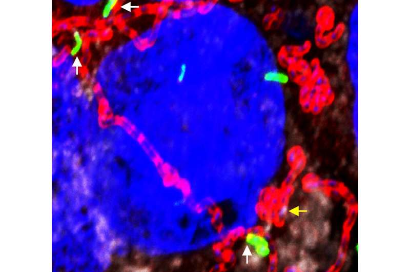 Bioengineered probiotic could prevent Listeria infections